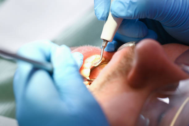 Best Cosmetic Emergency Dentistry in Huntley, IL