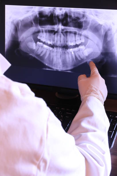 Best Emergency Treatment for Dental Infections or Abscesses in Huntley, IL