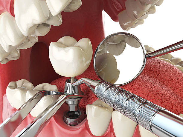 Best After-Hours Dental Trauma Care in Huntley, IL
